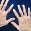 Blue Goo Cracked Heels & Dry Hands - Hydrating & Smoothing Moisturizer and Skin Softener - Made with 100% Pure Emu Oil - 2 pack, 2oz ea - Image 7