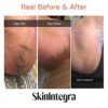 Skinintegra Rapid Crack Repair Cream, for foot and hand dry skin visible repair in one day 3oz - Image 4