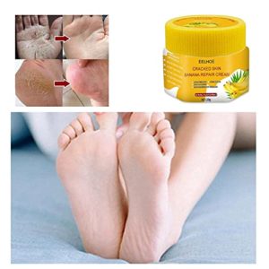 Cracked skin Banana Repair Cream, Natural Foot Soothing Cream -Exfoliating Moisturizing,Removes Hard Skin,Softens & Conditions Dry Skin, For Feet, Elbows, & Hands (1PCS)