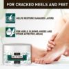 Urea Cream 40 Percent - Intensive Hydration for Dry and Cracked Heels, Feet, Hands, Elbows and Knees - Callus Remover for Women with Salicylic Acid - Helps Athletes Foot - Foot Odor - 4 oz - Image 3