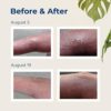 Gloves In A Bottle Shielding Lotion for Dry Itchy Skin, 8 ounce (12 Pack) - Image 6