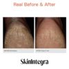 Skinintegra Rapid Crack Repair Cream, for foot and hand dry skin visible repair in one day 3oz - Image 5