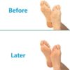 Pinkiou Moisturizing Gloves Socks Set Gel Spa for Moisturize Soften Repairing Dry Hands Feet Cracked Skin Care Silicone inside–Blue - Image 7
