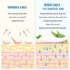Urea Cream 40 Percent for Feet Maximum Strength with 2% Salicylic Acid 5.29 Oz, Callus Remover, Dead Skin Exfoliation, Hand & Foot Cream for Dry Cracked Hands ,Elbows, Feet, Heels, Knees, Intensively Moisturizes & Softens &Repairs Skin - Image 4