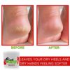 Crack Blaster Repair Balm, Multi-Purpose Dry Skin Balm, Intense Repair Treatment For Cracked Heels, Dry Cracked Hands, Finger and Elbow Treatment, Fragrance-Free Dry Cracked Skin Care - Image 4
