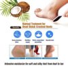 epielle New Moisturizing Socks and Gloves for Hand and Foot Care | Assorted 5 Pairs Socks (Socks 5 Pairs) | Skincare Gifts for Her - Image 8