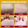 Cracked skin Banana Repair Cream, Natural Foot Soothing Cream -Exfoliating Moisturizing,Removes Hard Skin,Softens & Conditions Dry Skin, For Feet, Elbows, & Hands (1PCS) - Image 5