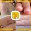 Cracked skin Banana Repair Cream, Natural Foot Soothing Cream -Exfoliating Moisturizing,Removes Hard Skin,Softens & Conditions Dry Skin, For Feet, Elbows, & Hands (1PCS) - Image 4