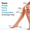 Urea Cream 40% Plus Salicylic Acid, 2-Pack, Callus Remover Hand Cream Foot Cream For Dry Cracked Feet, Hands, Heels, Elbows, Nails, Knees, Intensive Moisturizes & Softens Skin, Exfoliates Dead Skin - Image 3