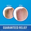 O'Keeffe's Working Hands Hand Cream, 3.4 Ounce Jar and Healthy Feet Foot Cream, 3.2 Ounce Jar - Image 5