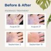 Gloves In A Bottle Shielding Lotion for Dry Skin, 8 Ounce - Image 7