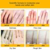5 Pairs of Anti-Aging Hand Cream Mask - Nuritious Honey and Almond Best Hydrating Hand & Nail Mask - Best Deep Moisturizing Gloves for Dry Hands to Nourishing, Softening, Hydrating and Protecting Skin - Image 3
