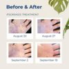 Gloves in a Bottle Shielding Lotion, Relief for Eczema and Psoriasis, 3.4 ounces (Pack of 2) - Image 4