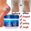Foot Cream Anti-Cracking Moisturizing Foot and Hand Cream Beauty, Foot Cream For Dry Cracked Heels, Cracked Heel Treatment Repair, Foot Lotion Soften Rough & Calloused Feet Hand (2Pcs) - Image 2