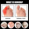 Die Toe Separator Socks, Breathable Women Toe Socks Full Finger Socks, Invisible Low Cut Ankle Orthoes Socks Correct and Realign Toes - Image 4
