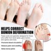Die Toe Separator Socks, Breathable Women Toe Socks Full Finger Socks, Invisible Low Cut Ankle Orthoes Socks Correct and Realign Toes - Image 9
